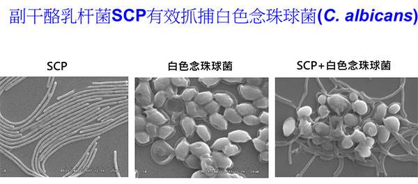 景岳副干酪乳桿菌SCP有效防治念珠菌