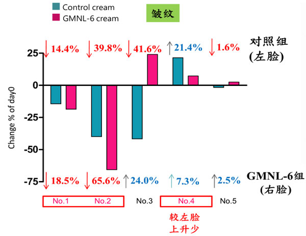 景岳GMNL-6減少面部皺紋